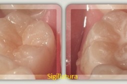 Sigilatura